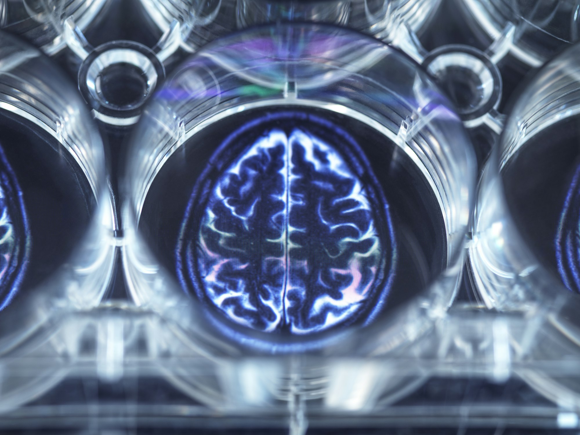 Pipetting potential cure for brain disorders into a multi well plate